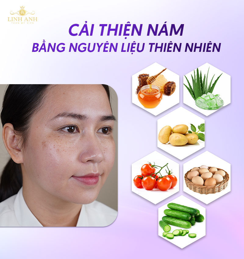 Cải thiện nám bằng nguyên liệu thiên nhiên