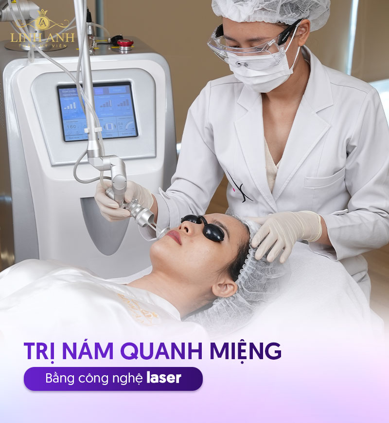 Trị nám ở miệng bằng laser