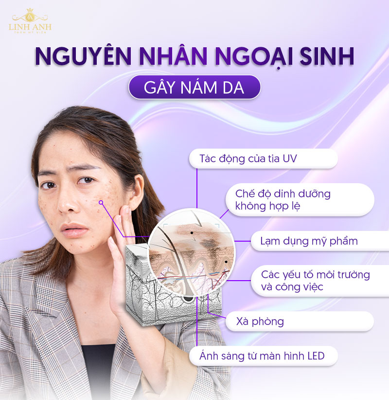 nám da do ngoại sinh