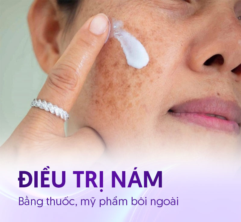 dùng thuốc điều trị nám