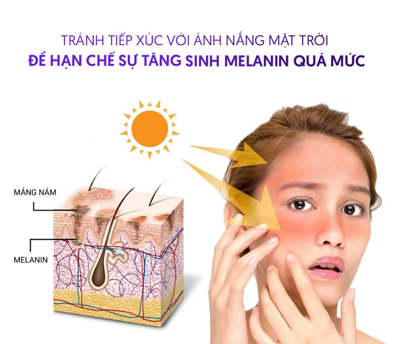 Hạn chế tăng sinh melanin quá mức