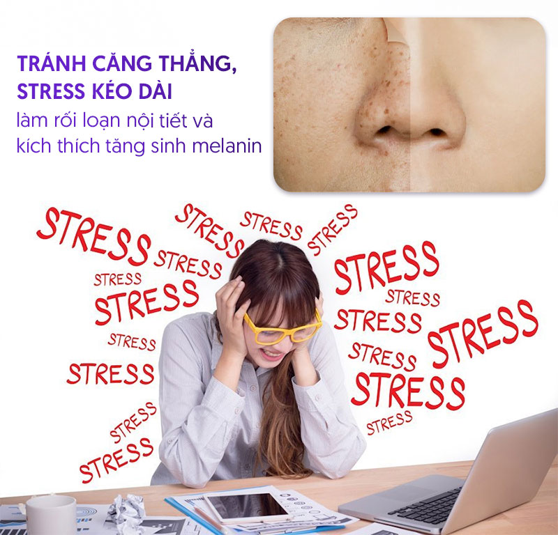 Tránh căng thẳng để giảm sắc tố melanin