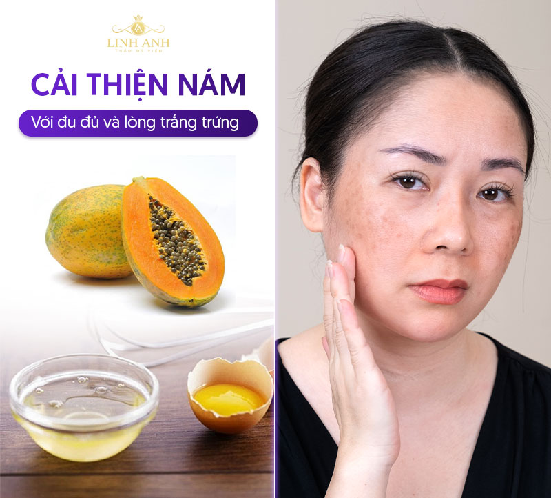 cải thiện nám với mặt nạ đu đủ kết hợp lòng trắng trứng