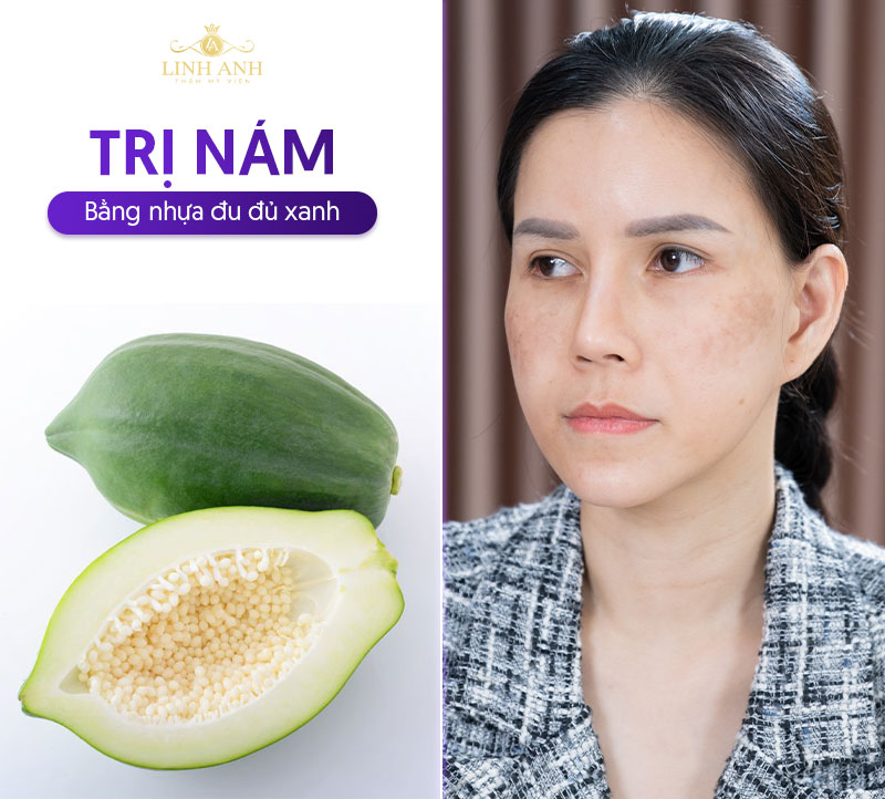 cách trị nám bằng đu đủ xanh