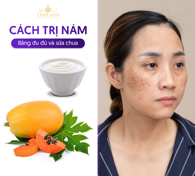 trị nám bằng đu đủ kết hợp sữa chua