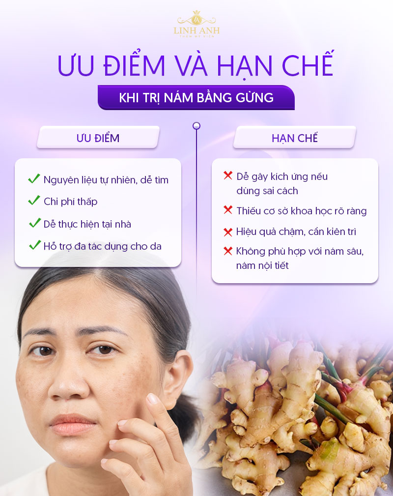 trị nám bằng gừng
