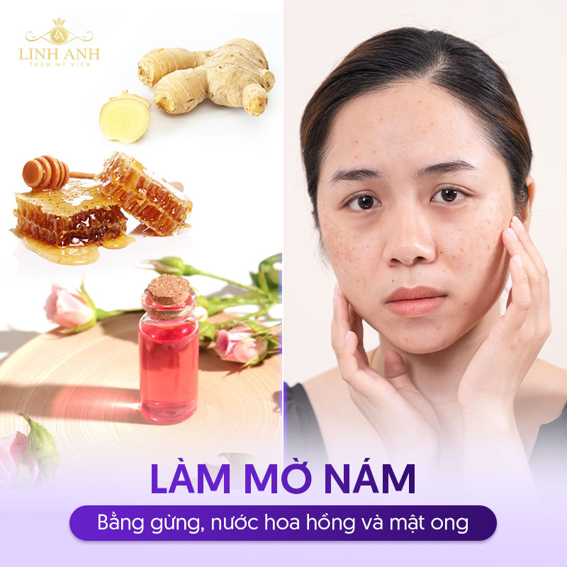 làm mờ nám với gừng