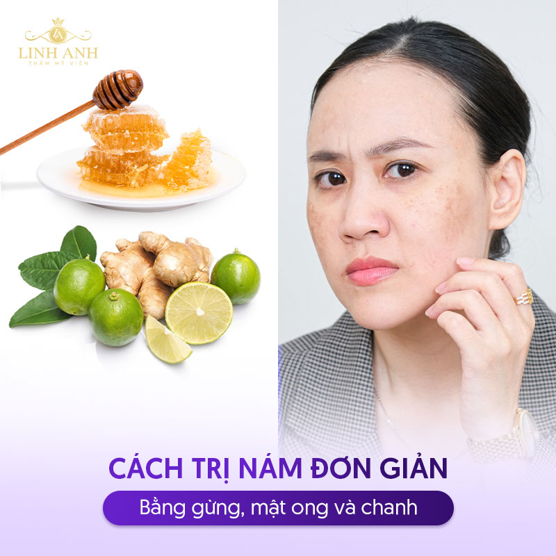 da nhạy cảm nên chú ý cách trị nám