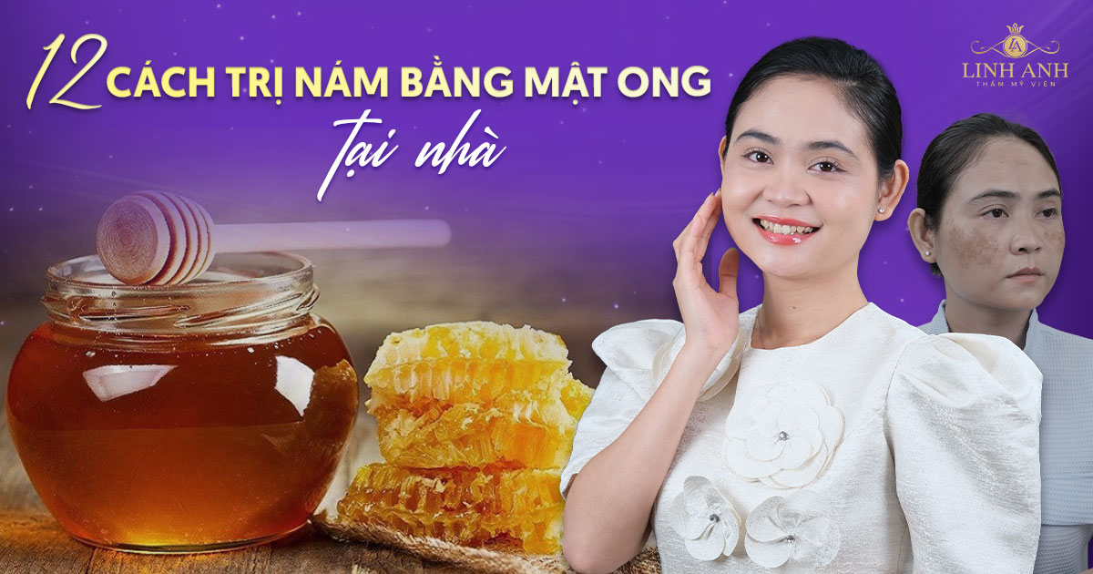 12 cách trị nám bằng mật ong hiệu quả và dễ làm ngay tại nhà