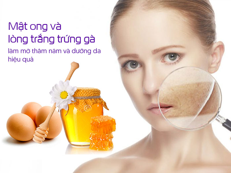 Trị nám bằng mật ong và lòng trắng trứng