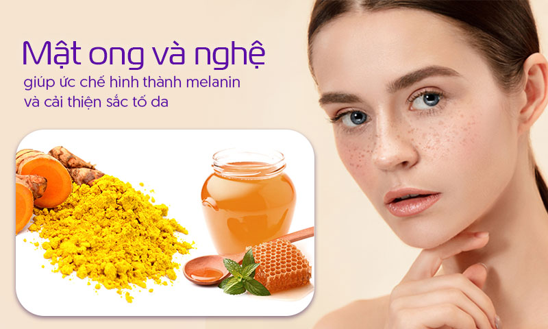 Trị tàn nhang bằng mật ong và nghệ