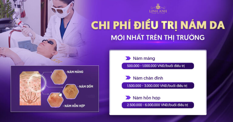 Chi phí điều trị nám da? Bảng giá điều trị nám mới nhất