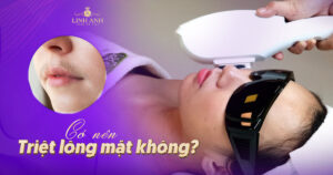 có nên triệt lông mặt