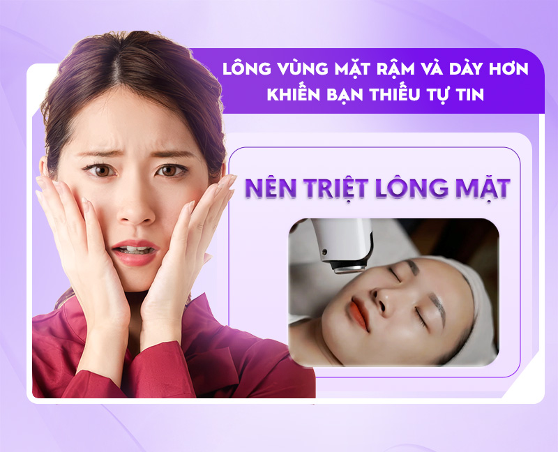 có nên triệt lông mặt không có nên triệt lông mặt không