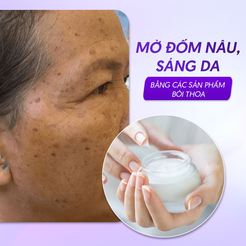 Điều chỉnh sắc tố đốm đồi mồi