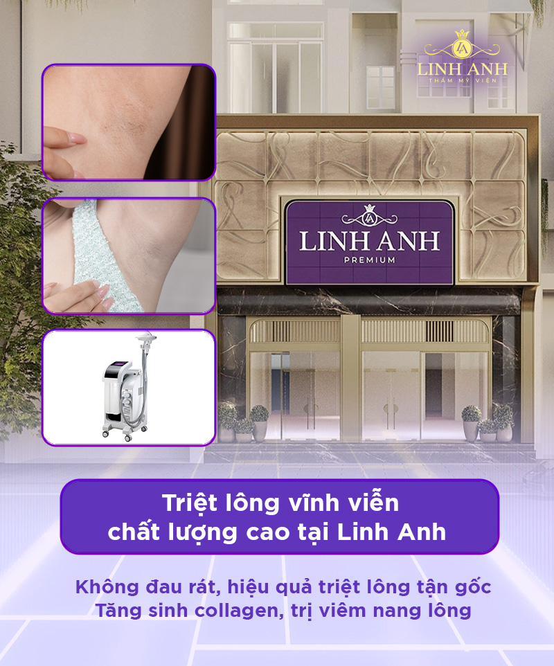 khách hang triệt long tại Linh Anh khách hang triệt long tại Linh Anh