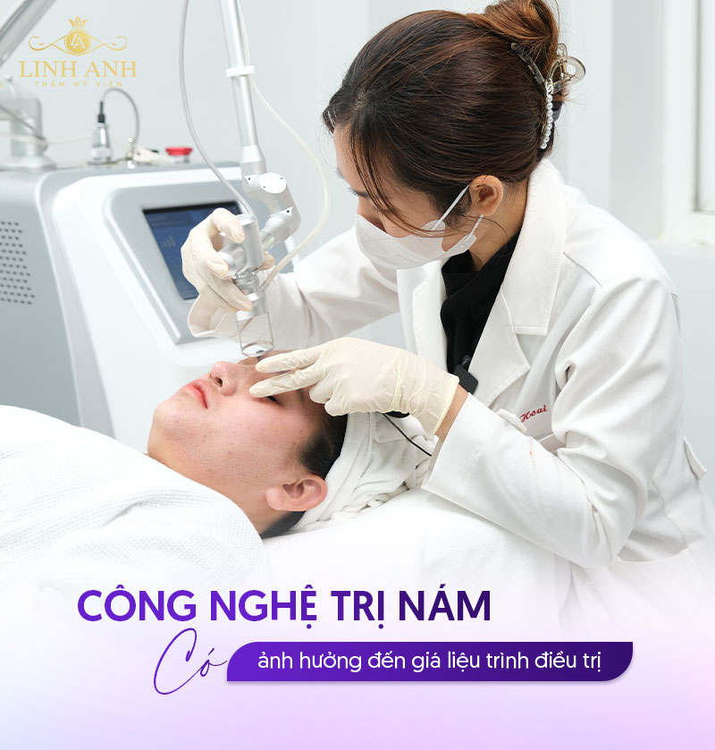 Trị nám giá bao nhiêu tùy vào công nghệ áp dụng