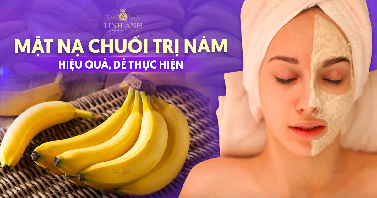 7 mặt nạ chuối trị nám hiệu quả, thực hiện ngay tại nhà
