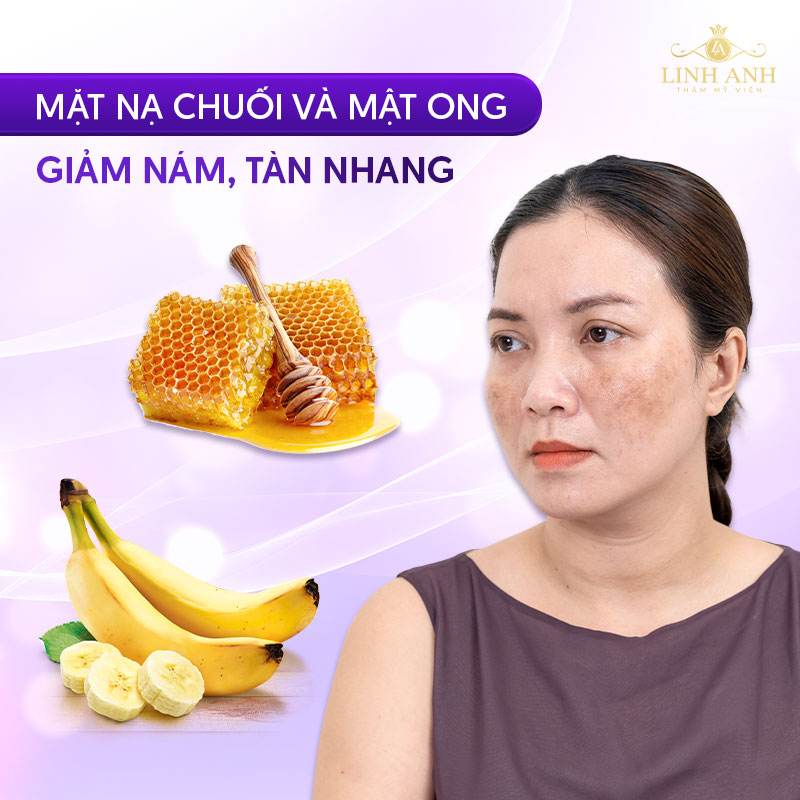 chuối kết hợp mật ong giúp giảm nám