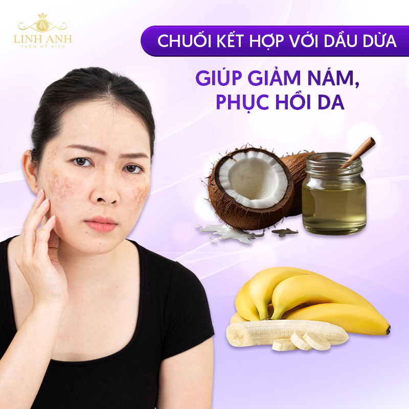 dùng chuối kết hợp với dầu dừa trị nám