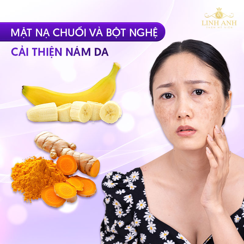 cải thiện nám da với mặt nạ chuối và bột nghệ