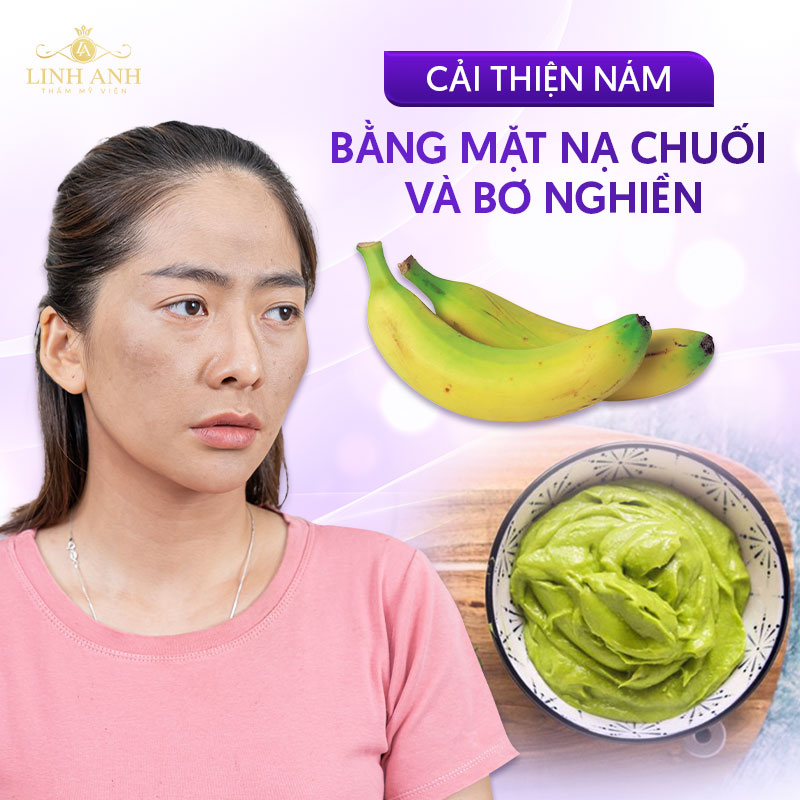 cải thiện sạm nám với bơ và dầu oliu