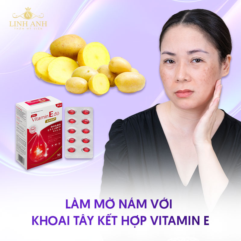 Dùng khoai tây và vitamin E trị nám