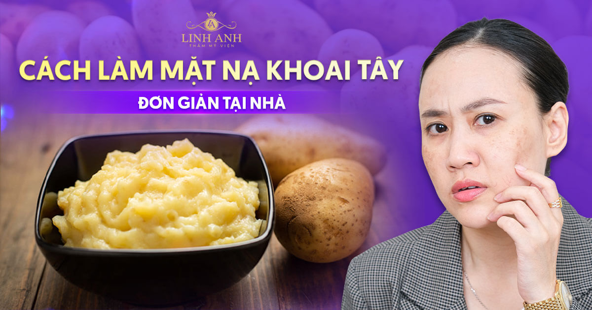 11 Cách làm mặt nạ khoai tây trị nám đơn giản tại nhà