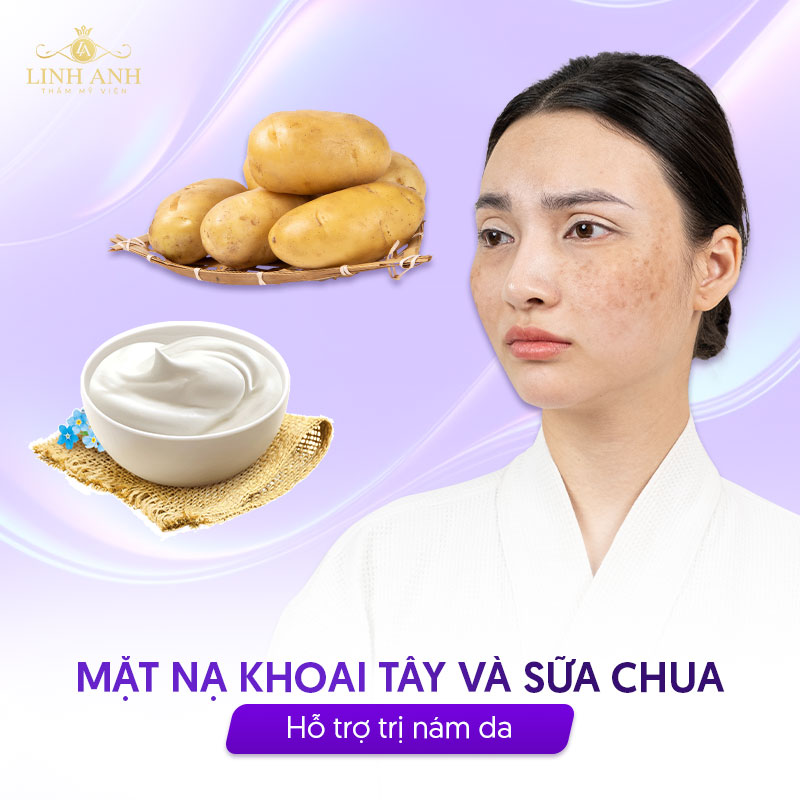 Mặt nạ khoai tây và sữa chua trị nám