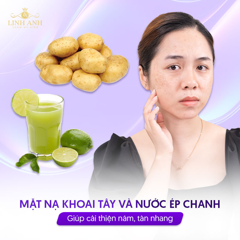 Trị nám bằng mặt nạ khoai tây và chanh