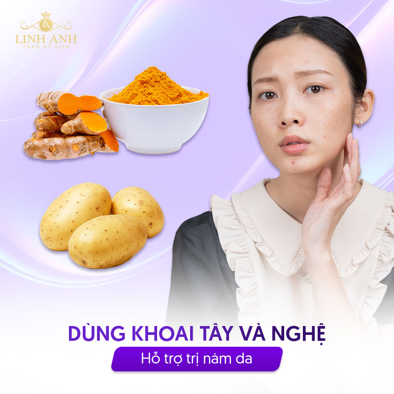 Dùng khoai tây và nghệ trị nám