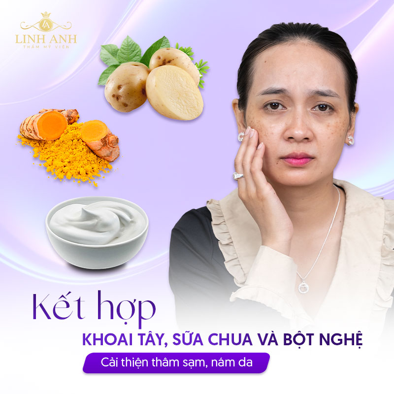 Mặt nạ khoai tây, sữa chua, bột nghệ trị nám