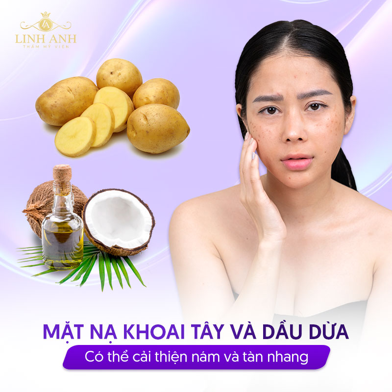 Mặt nạ khoai tây trị nám với dầu dừa