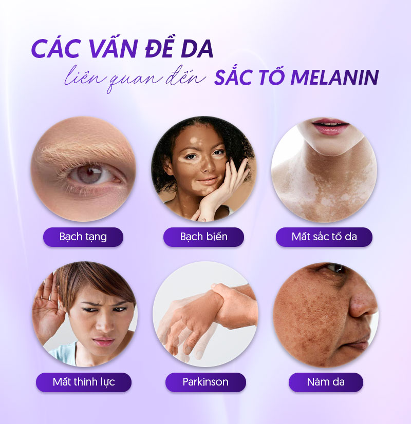 Ảnh hưởng của melanin với làn da