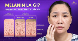 Melanin là gì