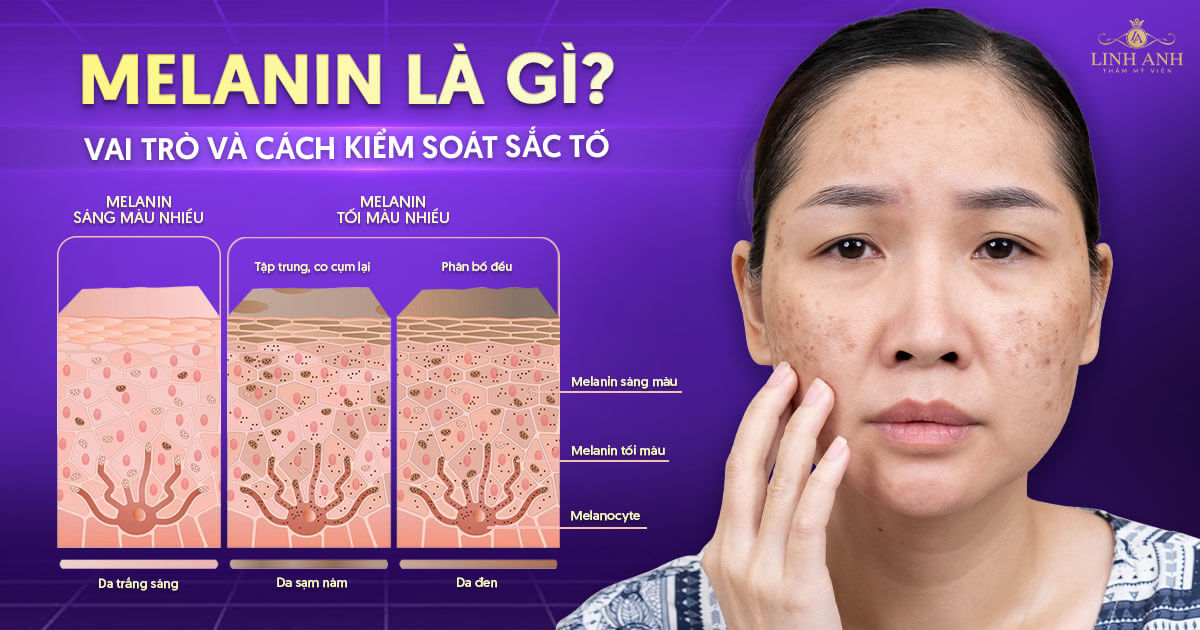 Melanin là gì? Vai trò và cách kiểm soát sắc tố hiệu quả