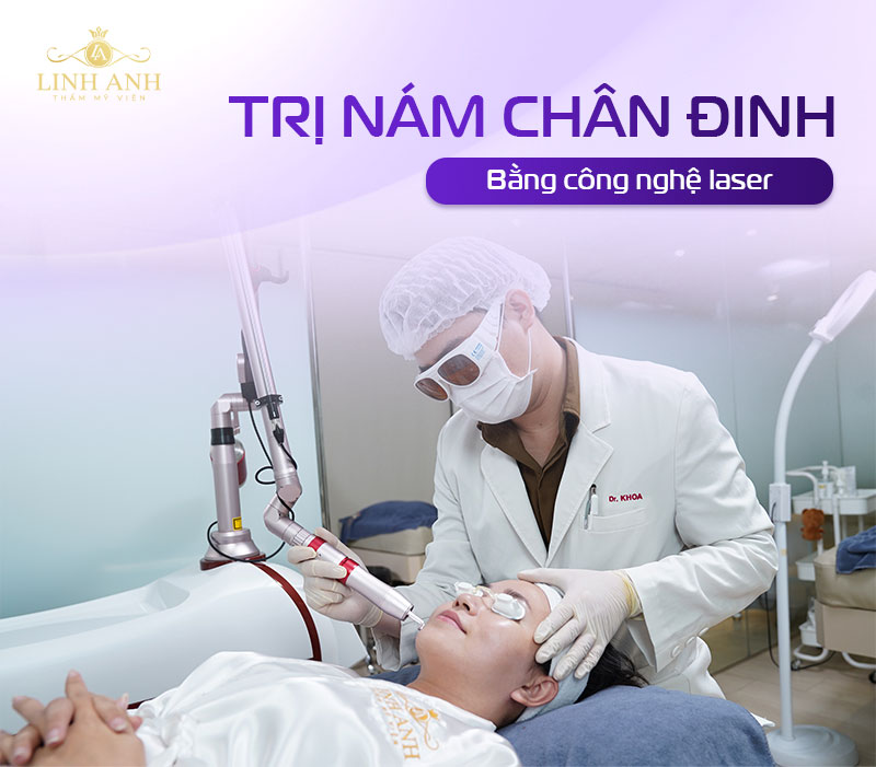 trị nám chân đinh bằng công nghệ