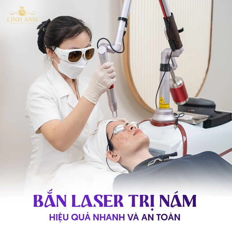 Điều trị nám chân sâu bằng laser