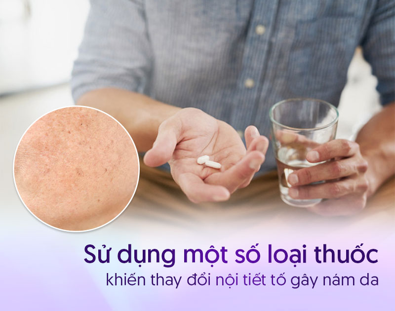 Nám da mặt ở nam giới do thuốc