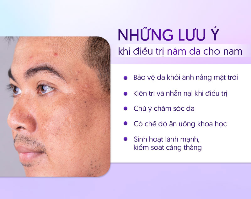 Đàn ông bị nám da mặt nên sinh hoạt lành mạnh