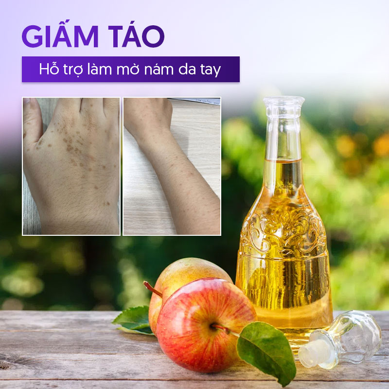 Cách trị nấm tay với giấm táo
