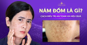 nám đốm