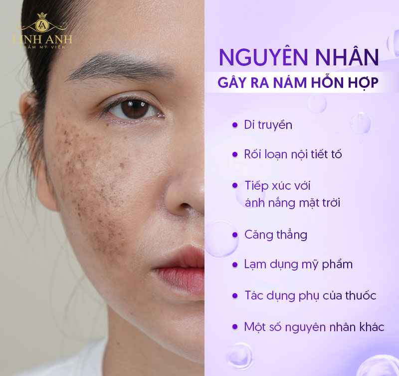 Nguyên nhân dẫn đến nám hỗn hợp