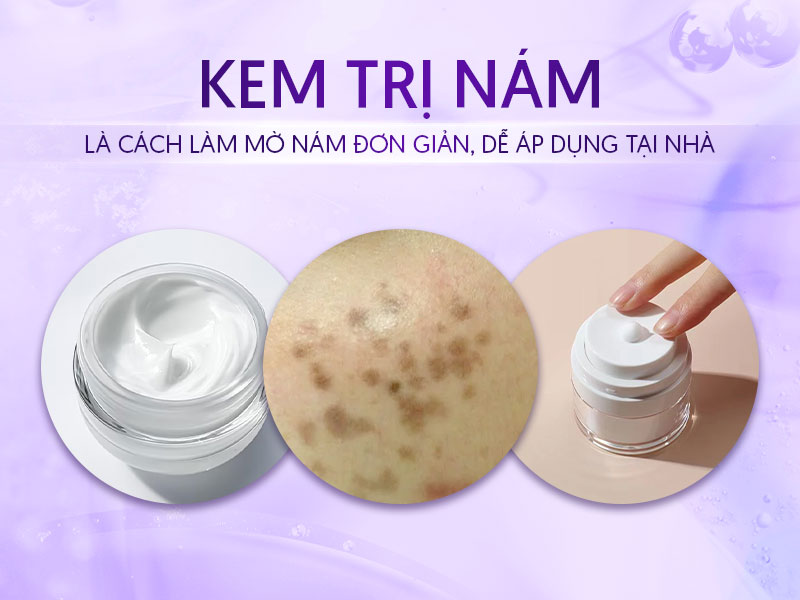 Kem đặc trị nám hori