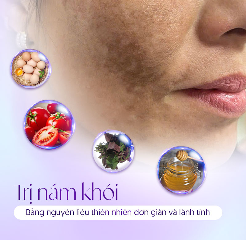 trị nám khói