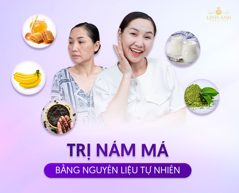 dùng nguyên liệu tự nhiên trị nám má