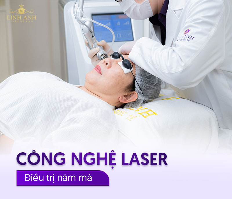 dùng công nghệ laser để trị nám