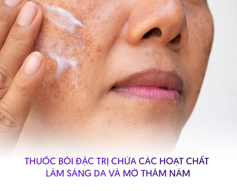 Thuốc bôi trị nám mảng