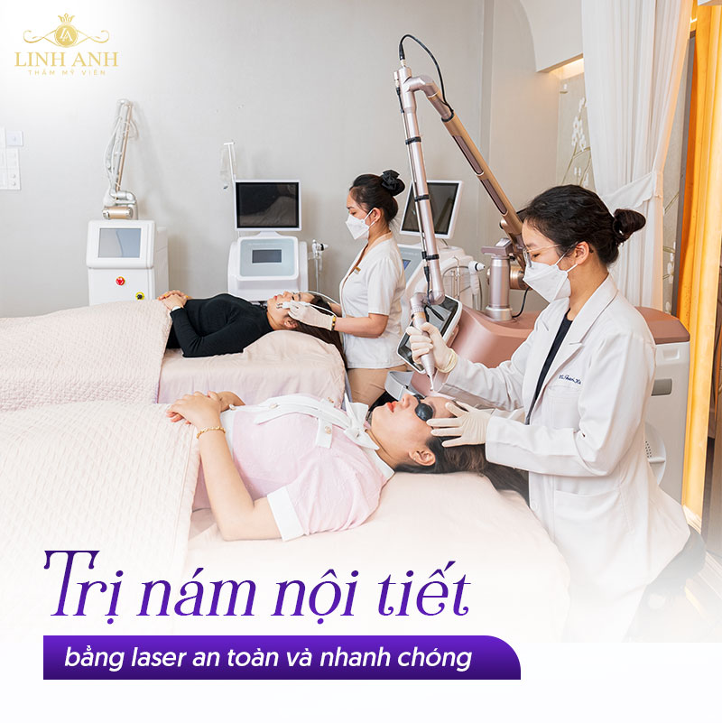 Cách trị nám nội tiết bằng laser