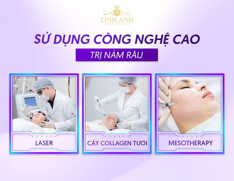 dùng công nghệ cao trị nám